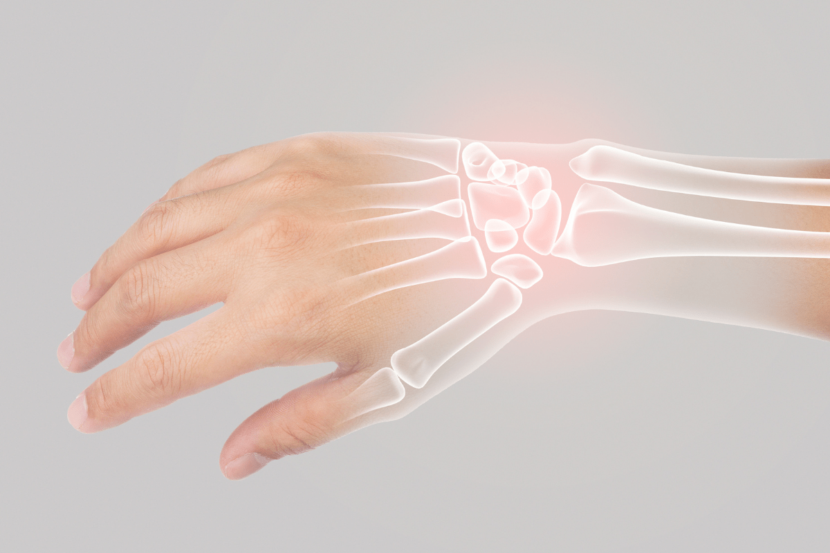 A human hand with an overlay of X-ray-style bones.