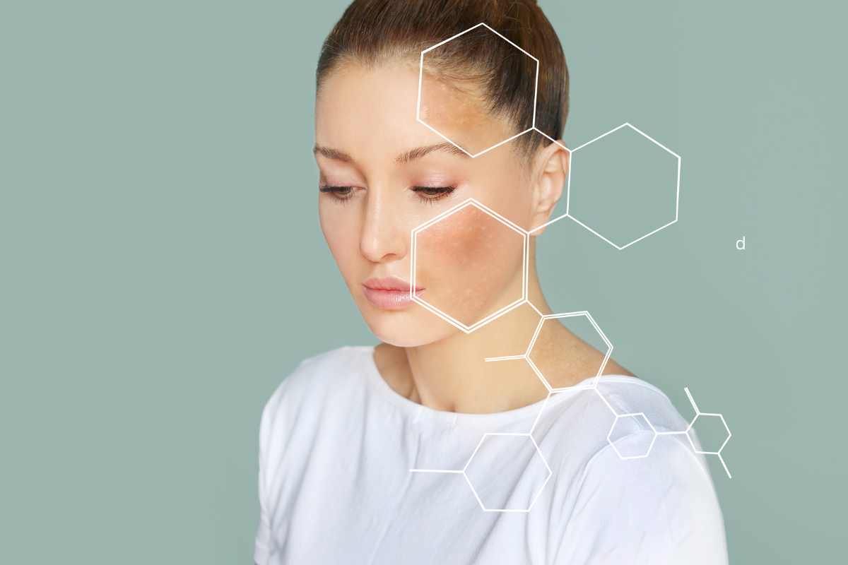 Woman with dry, flaky skin on her cheek, shown with hexagonal graphics highlighting the affected area.